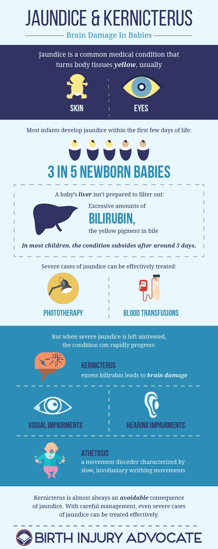 Jaundice And Kernicterus Brain Damage In Babies Infographic 