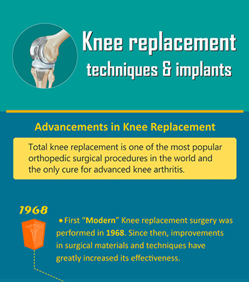 Knee Replacement Techniques and Implants Infographic 