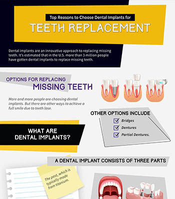 Top Reasons to Choose Dental Implants for Teeth Replacement Infographic