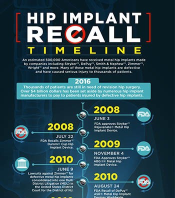 Hip Implant Recall Timeline Infographic