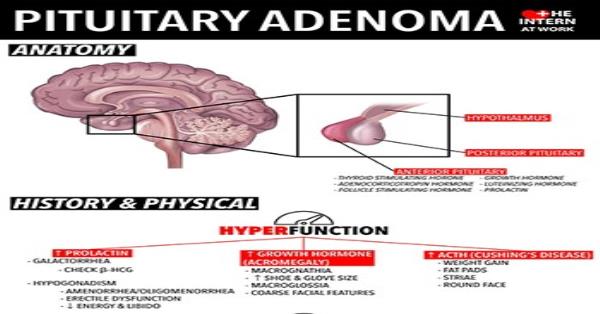 pituitary-adenoma-infographic-infographics-medicpresents