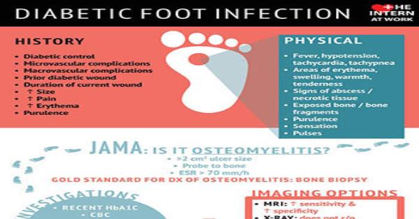 Diabetic Foot Infection Infographic Infographics | Medicpresents.com