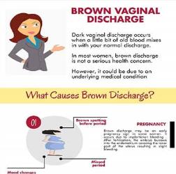 brown mucus discharge