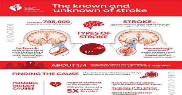 The Known and Unknown of Stroke Infographic by AHA Infographics ...