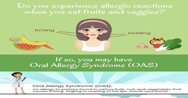 Oral Allergy Syndrome Symptom Infographic Infographics | Medicpresents.com