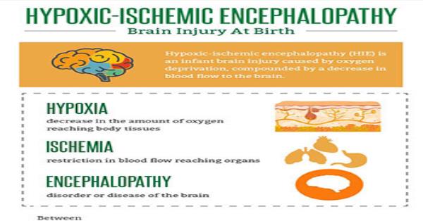 Hypoxic-Ischemic Encephalopathy - Infographics and Images