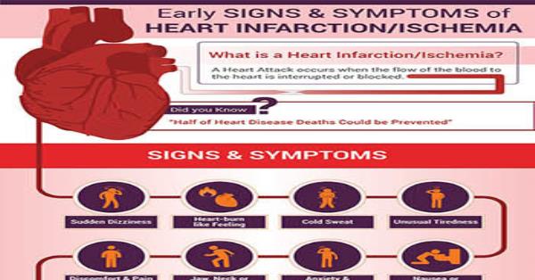 Early Signs and Symptoms of Heart Disease Infographic Infographics ...