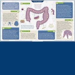 Free Gastroenterology and Digestive System Infographics | MedicPresents.com