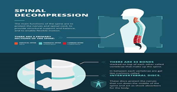 Spinal Decompression Infographic Infographics | Medicpresents.com