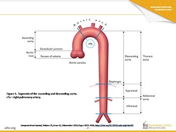 The Aorta 101