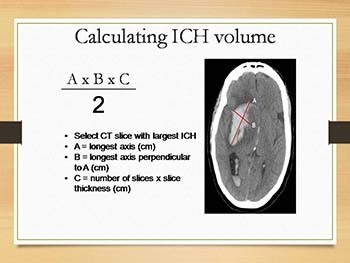 Intracerebral Hemorrhage (ICH)