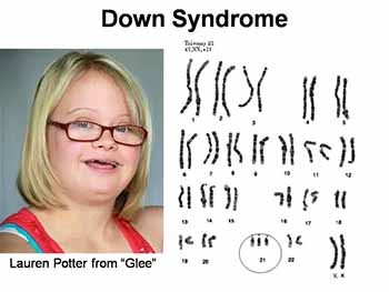 Karyotypes and Chromosomal Disorders