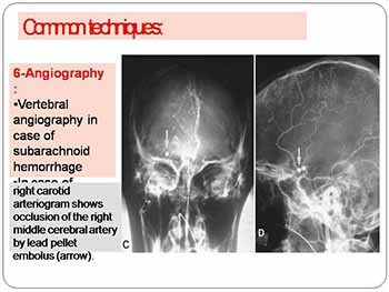 Forensic radiology