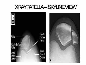 Lower limb radiology