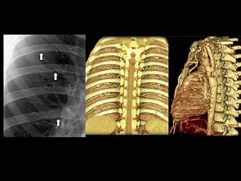 Cases in Pediatric Radiology