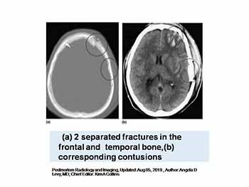 Forensic Radiology