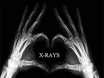 Diagnostic Radiology