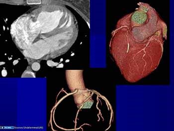 Basic Cardiac Radiology