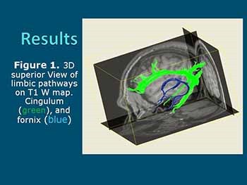 Research in Radiology