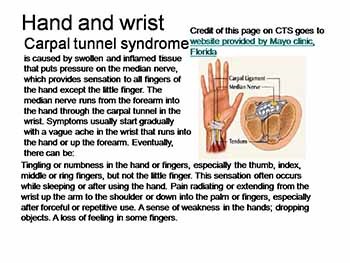 Work related Musculoskeletal Disorders