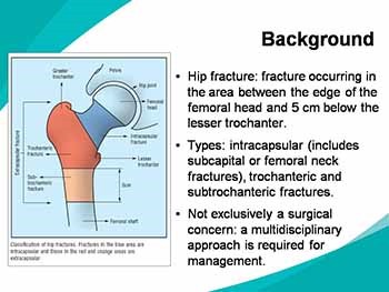 About Hip fracture