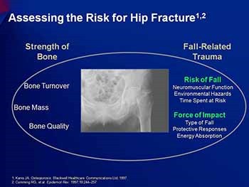 Recovering From Hip Fracture