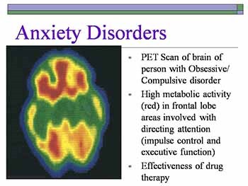 Psychological Disorders