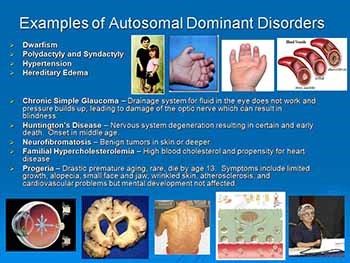 Autosomal Dominant Autosomal Recessive and Sex-linked Disorders and Pedigrees