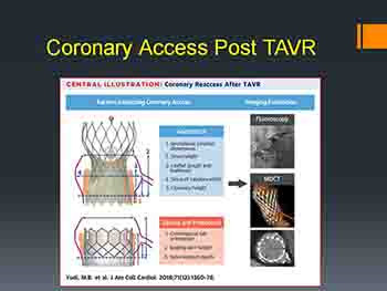 Tavr-Transcatheter Treatment of Aortic Stenosis Comes of Age
