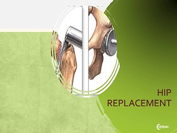 Hip Replacement