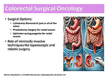 Site-Specific Surgical Oncology