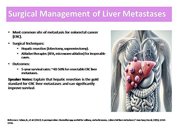 Surgical Management of Metastases