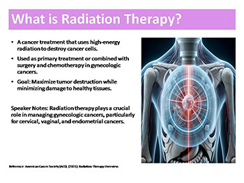 Radiation Therapy in Gynecologic Oncology