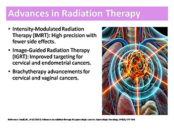 Advances in Gynecologic Oncology