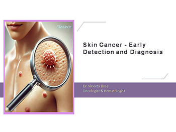 Skin Cancer - Early Detection and Diagnosis