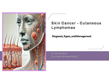 Skin Cancer - Cutaneous Lymphomas