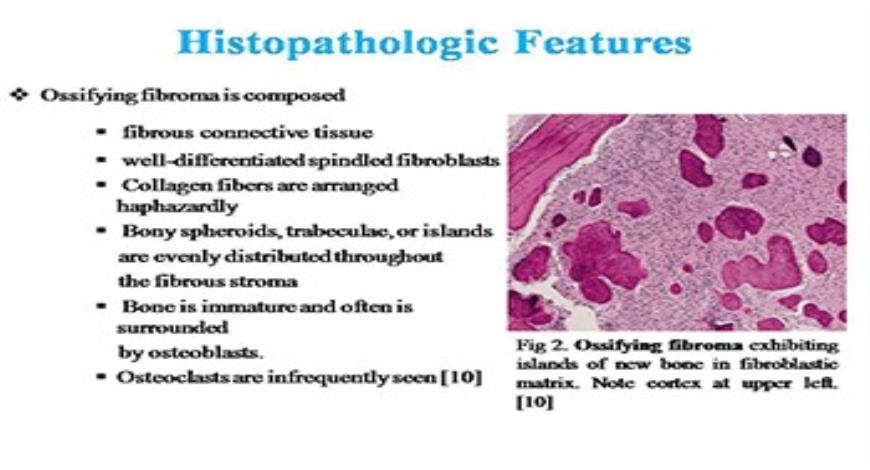 Download Free Medical Management of Fibro-osseous lesions PowerPoint ...