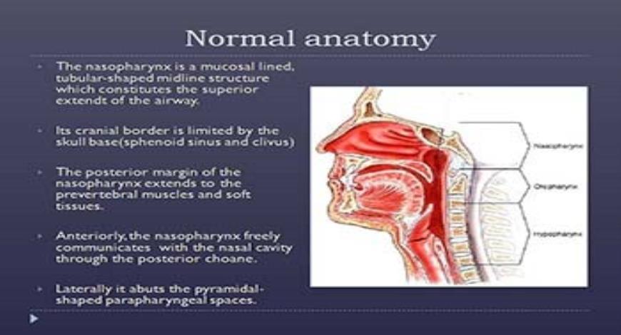 Download Free Medical Imaging of nasopharyngeal carcinoma PowerPoint ...