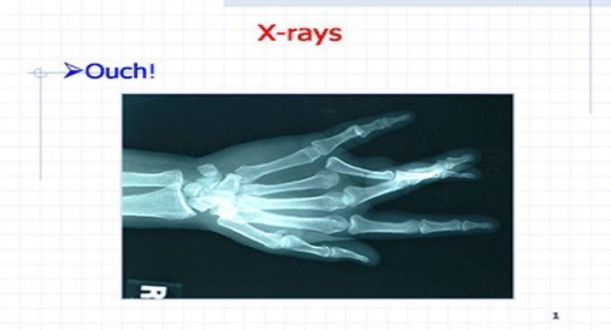 X-rays Medical Presentation