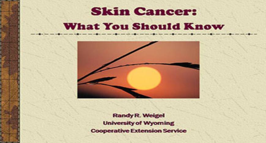 Download Free Medical Skin Cancer What You Should Know PowerPoint ...
