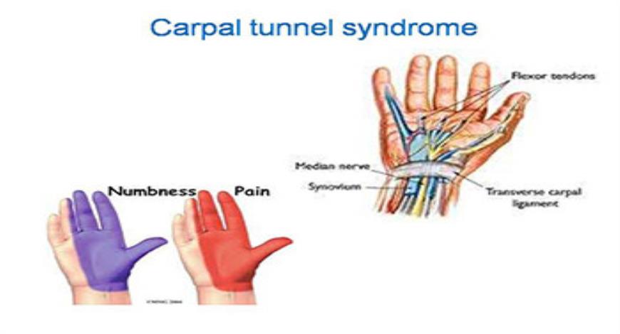 Download Free Medical Ergonomics PowerPoint Presentation