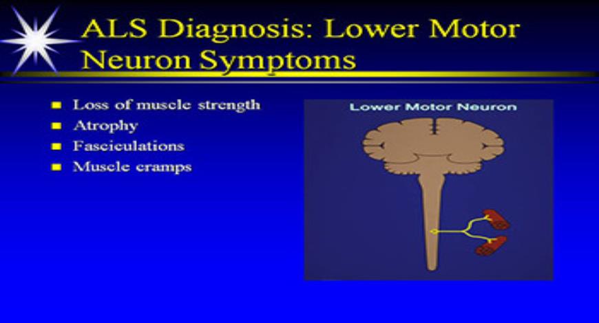 Download Free Medical Motor Neuron Diseases PowerPoint Presentation