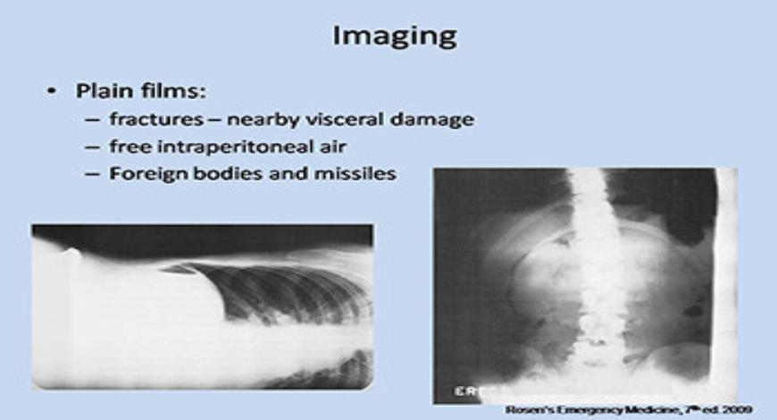 Trauma(1) abdominal.ppt