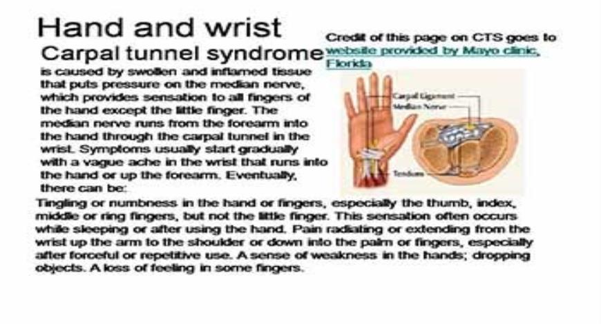 Download Free Medical Work related Musculoskeletal Disorders PowerPoint ...