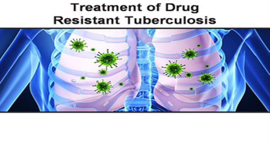 Download Free Medical Treatment of Drug-Resistant Tuberculosis ...