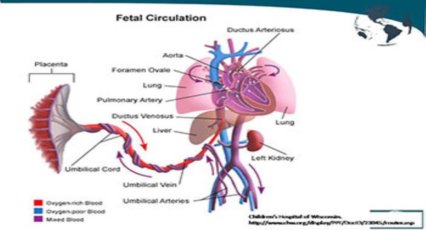 Download Free Medical Pulmonary Hypertension in Congenital Heart ...