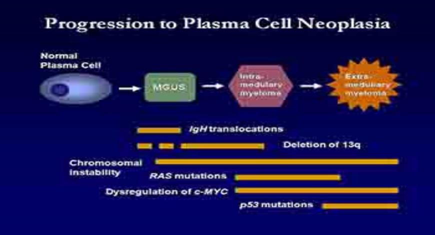 power point presentation on multiple myeloma