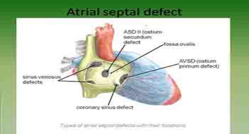 Download Free Medical Congenital Heart Diseases PowerPoint Presentation