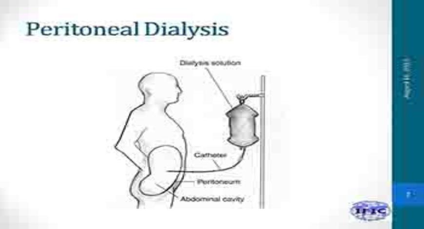 Download Free Medical Hemodialysis And Peritoneal Dialysis PowerPoint ...