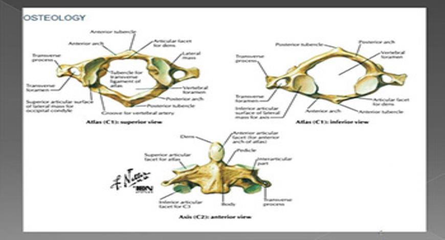 Download Free Medical Cervical Spine Injuries PowerPoint Presentation